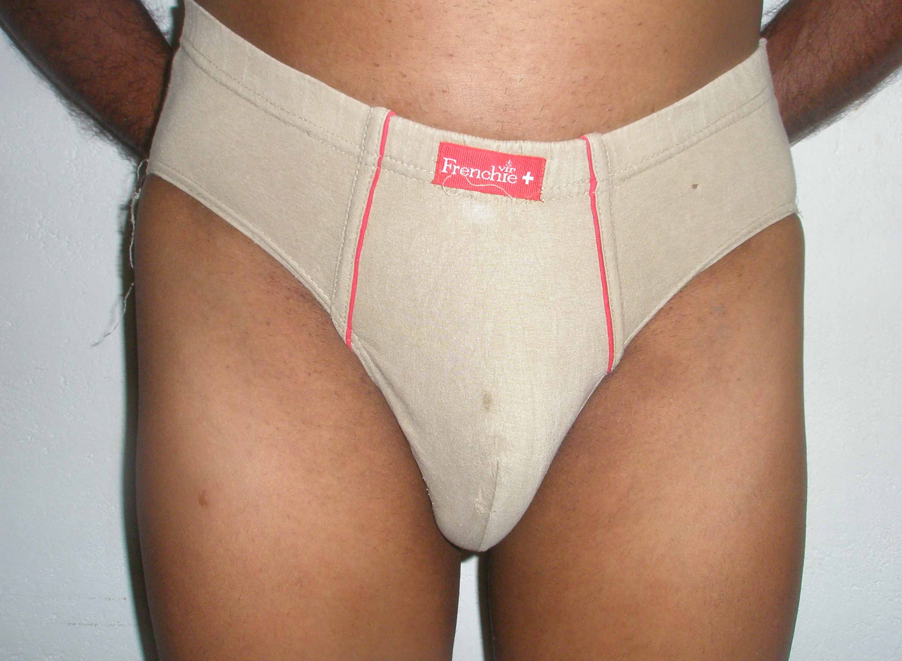 Implanted penis fitted with AMS Spectra-Penis kept in flaccid position - Front view.JPG